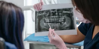 Jak przygotować się do wszczepienia implantu zębowego? implanty.naturaldens.pl - 388-jak-przygotowac-sie-do-wszczepienia-implantu-zebowego.webp